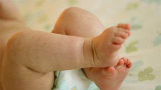 Diaper rash in newborns